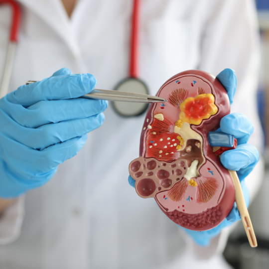 Advanced or chronic kidney disease