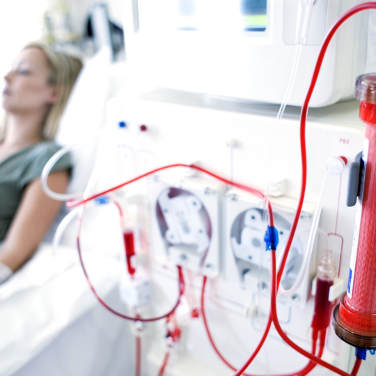 Peritoneal Dialysis